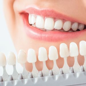 Lächelnde Person mit Zahnfarbskala für Zahnersatz